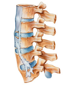 ankylosing spondylitis