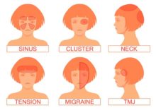 types of headache and location meaning