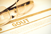 how long does gout last