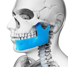 jaw pain