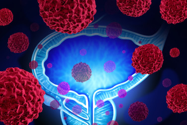 Illustration of prostate