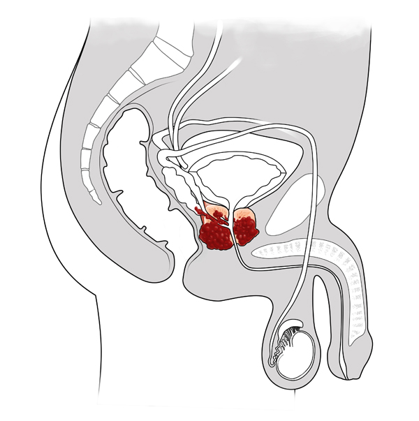 Illustration of prostate