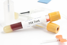 psa test blood test