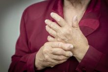 rheumatoid arthritis