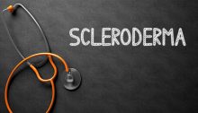 scleroderma