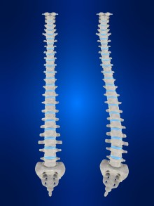 scoliosis pain